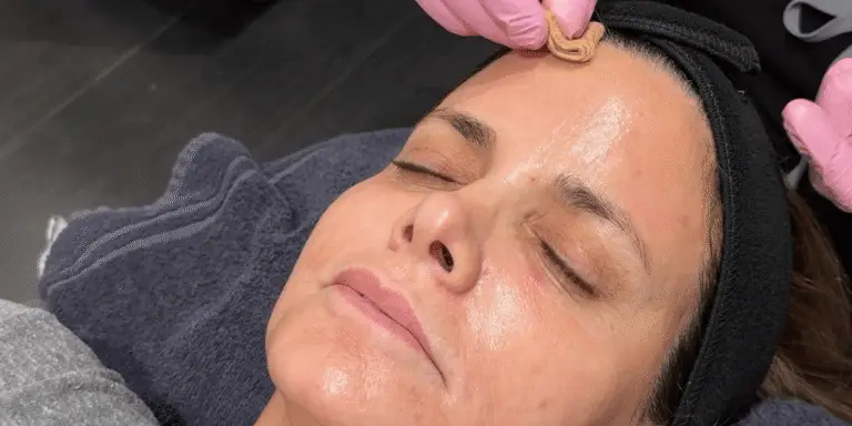 Chemical peel treatment application at Corinne Aesthetics