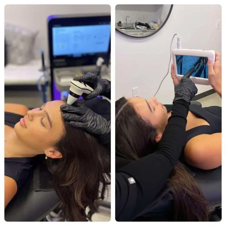 HydraScalp consultation and scalp analysis image